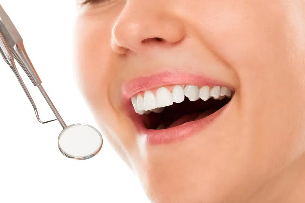 Cosmetic Dentistry