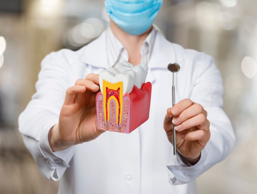 Root Canal Treatment